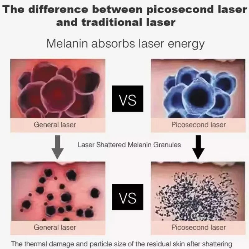 Laser Tattoo Machine